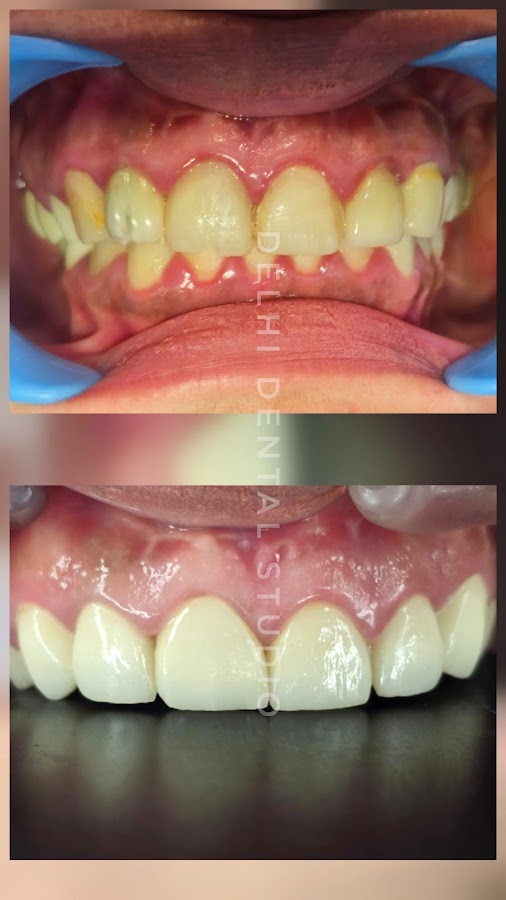 Delhi Dental Studio
