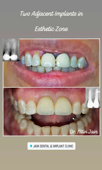 Jain Dental & Implant Clinic‐Delhi