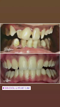 Jain Dental & Implant Clinic‐Delhi