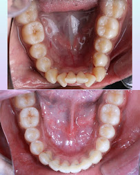 Delhi Dental and Implant centres ( Pusa road, Vasant vihar, Manipal hospital ( Ghaziabad)
