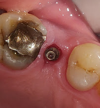 DIVINE DENTISTRY IMPLANTS & LASER CENTRE