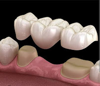 DIVINE DENTISTRY IMPLANTS & LASER CENTRE
