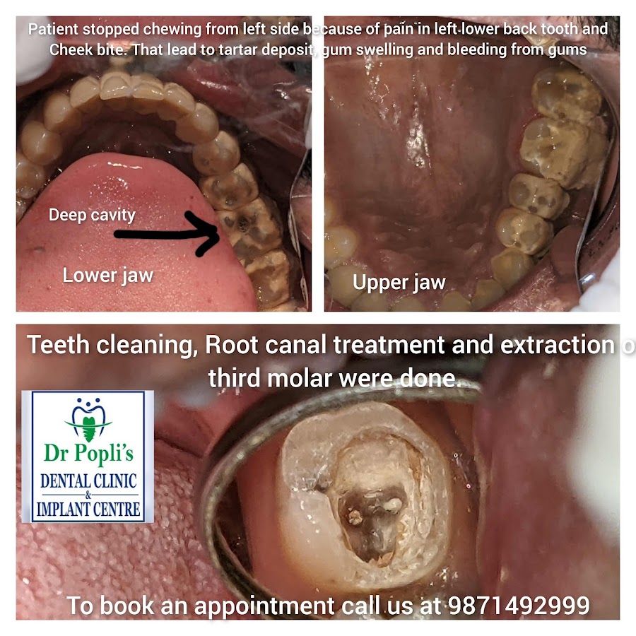 Dr Popli's dental clinic in New Delhi