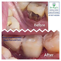 Dr Popli's Dental Clinic And Implant Centre