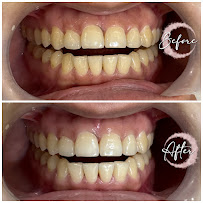 Dentales : Multispeciality Dental Clinic and Implant Center In South Delhi