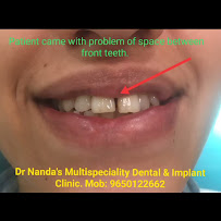 Dr Nanda's Multispeciality Dental & Implant Clinic.Best dental implant specialist.Best braces specialist.Best kids dentist.