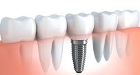 Gupta Dental & Implant Clinic | Best Dentist with 20 Years Experience