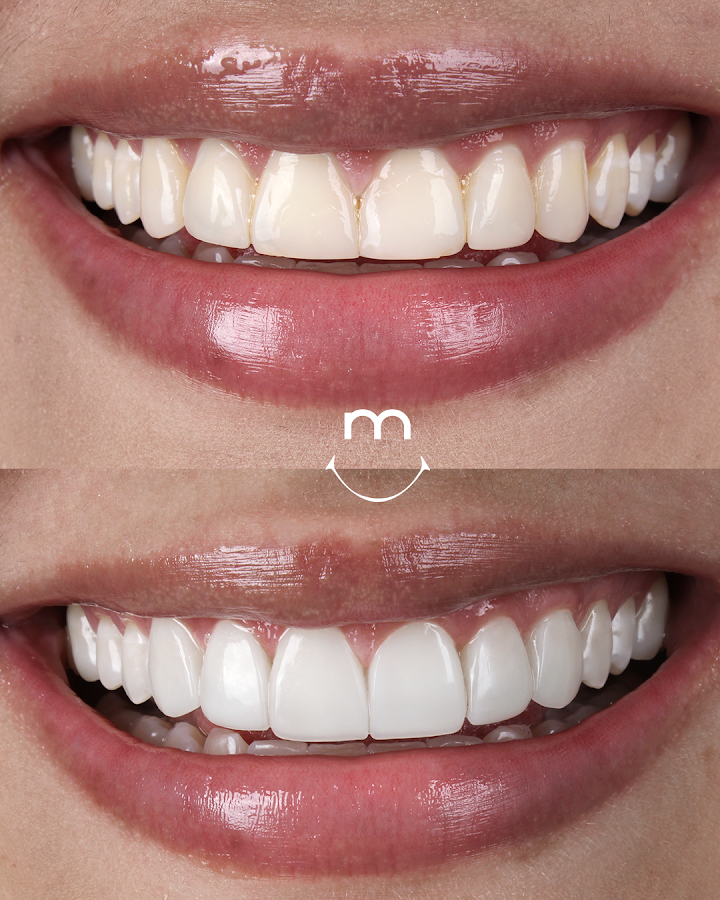 Odontología The Best Smile Centro Medellín - dental clinic in Medellin, Colombia