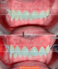 Odontología The Best Smile Centro Medellín