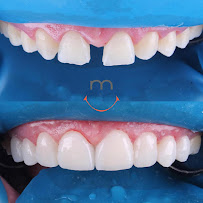 Odontología The Best Smile Centro Medellín