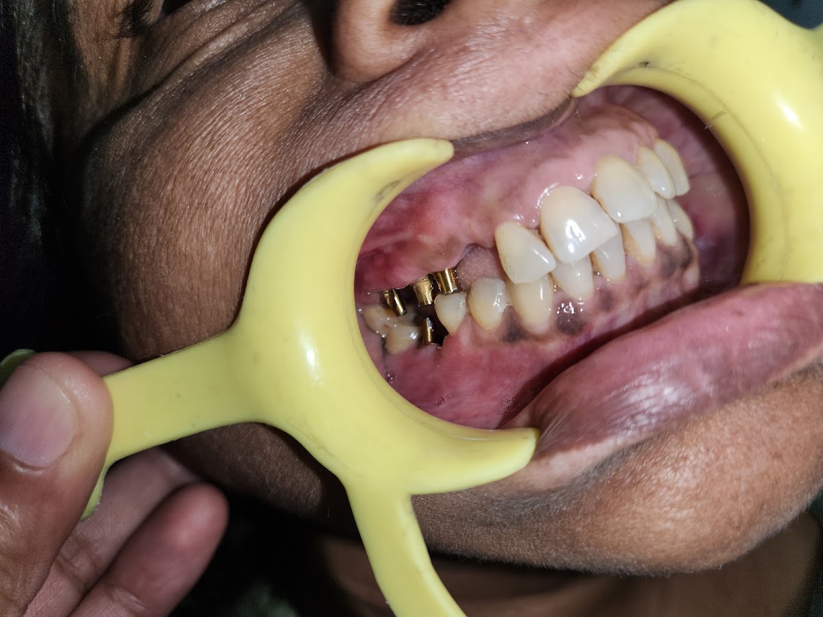 Abhinav Dental and Implant Centre dental clinic in New Delhi