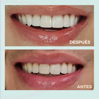 Dora Álvarez