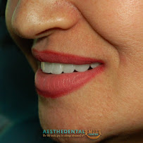 AestheDental Dental Clinic