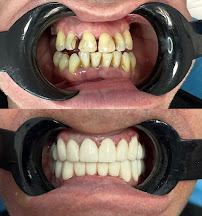 Sinem Yavuz Ağız ve Diş Sağlığı Muayenehanesi / Sinem Yavuz Dental Clinic Turkey / Antalya