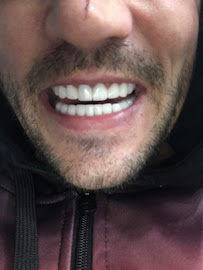 NFSDental