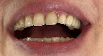 DS Dental Clinics Antalya | Liman Mahallesi Diş Kliniği | Implant, Protez, Ortodonti, Gülüş Tasarımı, Çocuk Diş Hekimliği