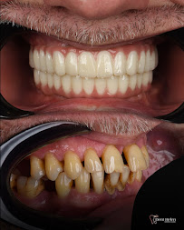 Dent Helen | Dental Clinic | Ağız ve Diş Sağlığı Polikliniği