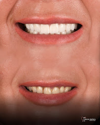 Dent Helen | Dental Clinic | Ağız ve Diş Sağlığı Polikliniği