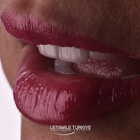Letsmile Türkiye
