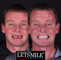 Letsmile Türkiye
