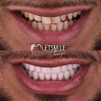 Letsmile Türkiye