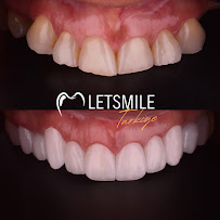 Letsmile Türkiye