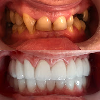 Monarch Internetional Dentistry