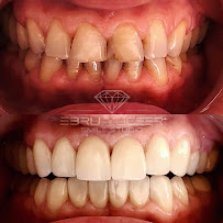 Monarch Internetional Dentistry