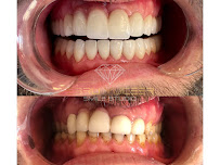 Monarch Internetional Dentistry