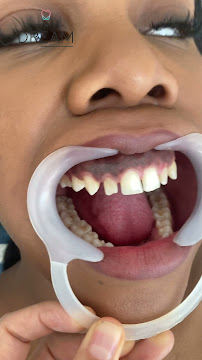 Dental Dream Turkey