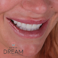 Dental Dream Turkey in Antalya