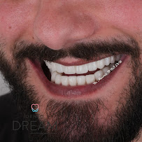 Dental Dream Turkey