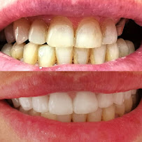 Diş Hekimi Işılay Dursun (dentist) (стоматолог анталия)