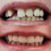 Diş Hekimi Işılay Dursun (dentist) (стоматолог анталия)