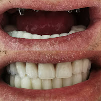 Diş Hekimi Işılay Dursun (dentist) (стоматолог анталия)