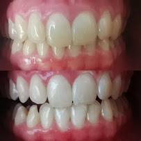 Diş Hekimi Işılay Dursun (dentist) (стоматолог анталия)