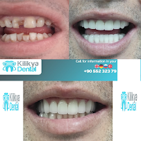Kilikya Dental - Hüseyin Yoldan Ağız Ve Diş Sağlığı Polikliniği