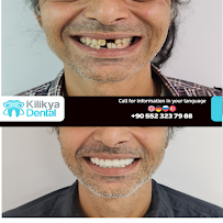 Kilikya Dental - Hüseyin Yoldan Ağız Ve Diş Sağlığı Polikliniği