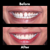 Coral Dental - Best Dental Clinic in North Delhi| Cosmetic Dentist Delhi