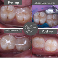 Coral Dental - Best Dental Clinic in North Delhi| Cosmetic Dentist Delhi