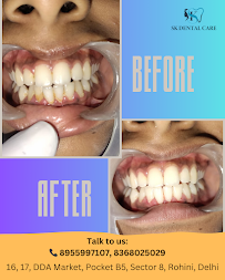 SK Dental Care- Aesthetic Clinic| Best Dental clinic in Delhi| Best Dental clinic in Rohini| Best RCT| Best Implant in Rohini