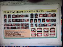 Dr. Gupta's Dental and Braces Clinic- Dentist in Delhi, Dental Implant, RCT, Dental Surgeon, Best Cosmetic Dentist in Rohini
