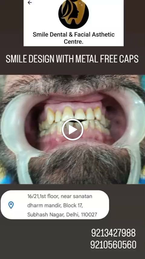 Smile Dental & Facial Aesthetic Centre dental clinic in New Delhi