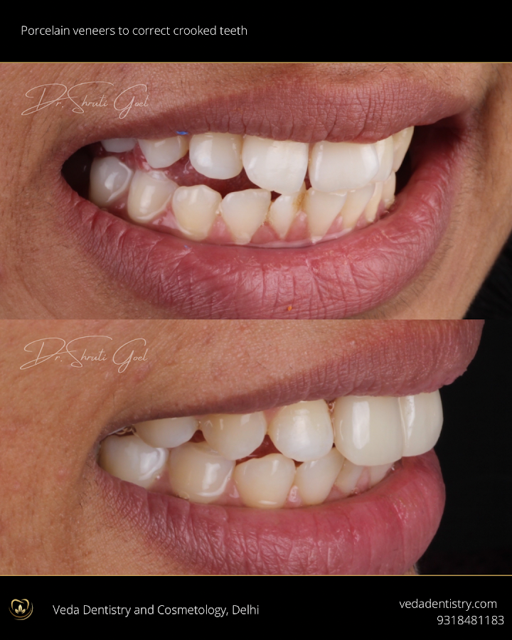 Veda Dentistry and Cosmetology dental clinic in New Delhi