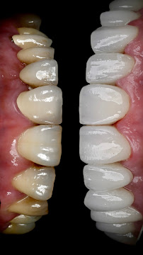Gk Dental in Antalya