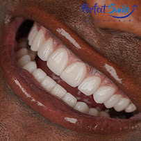 Perfect Smile Experience