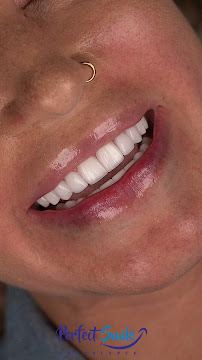 Perfect Smile Experience