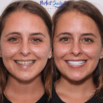 Perfect Smile Experience