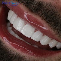 Perfect Smile Experience