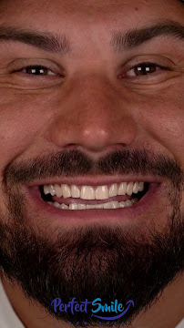 Perfect Smile Experience